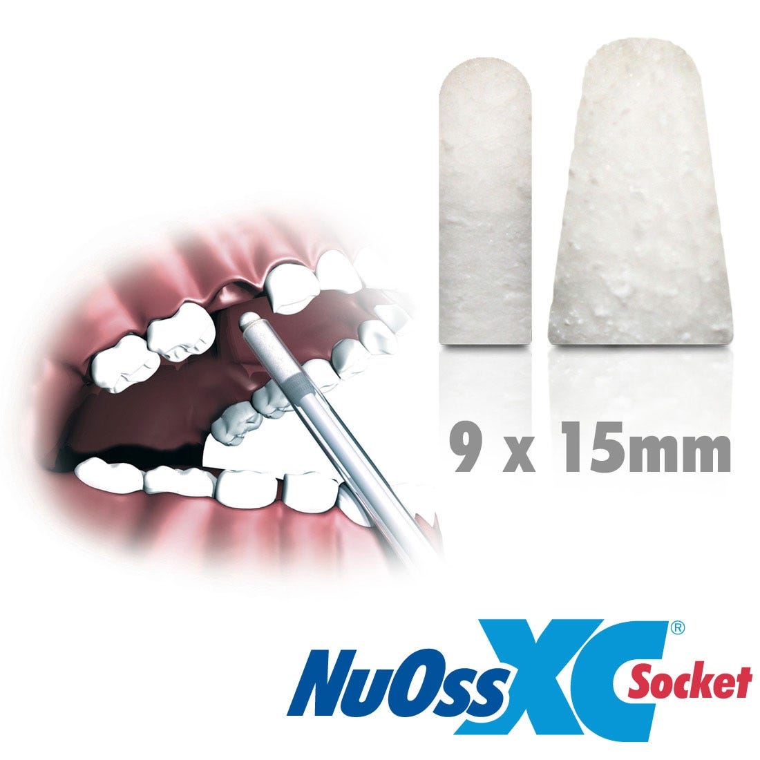 NuOss® XC Socket - 9 x 15mm