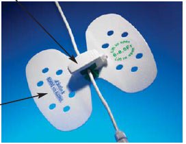 StatLock® Stabilization Device