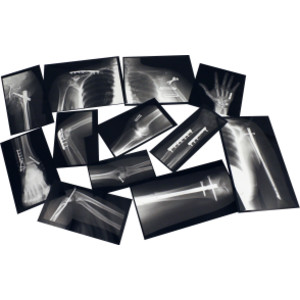 Fixed Bones X-Ray Set
