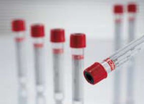 Vacuette® Z Serum Sep Clot Activator Venous Blood Collection Tube, 5 mL