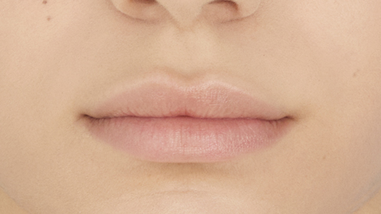 Immagine prima del trattamento