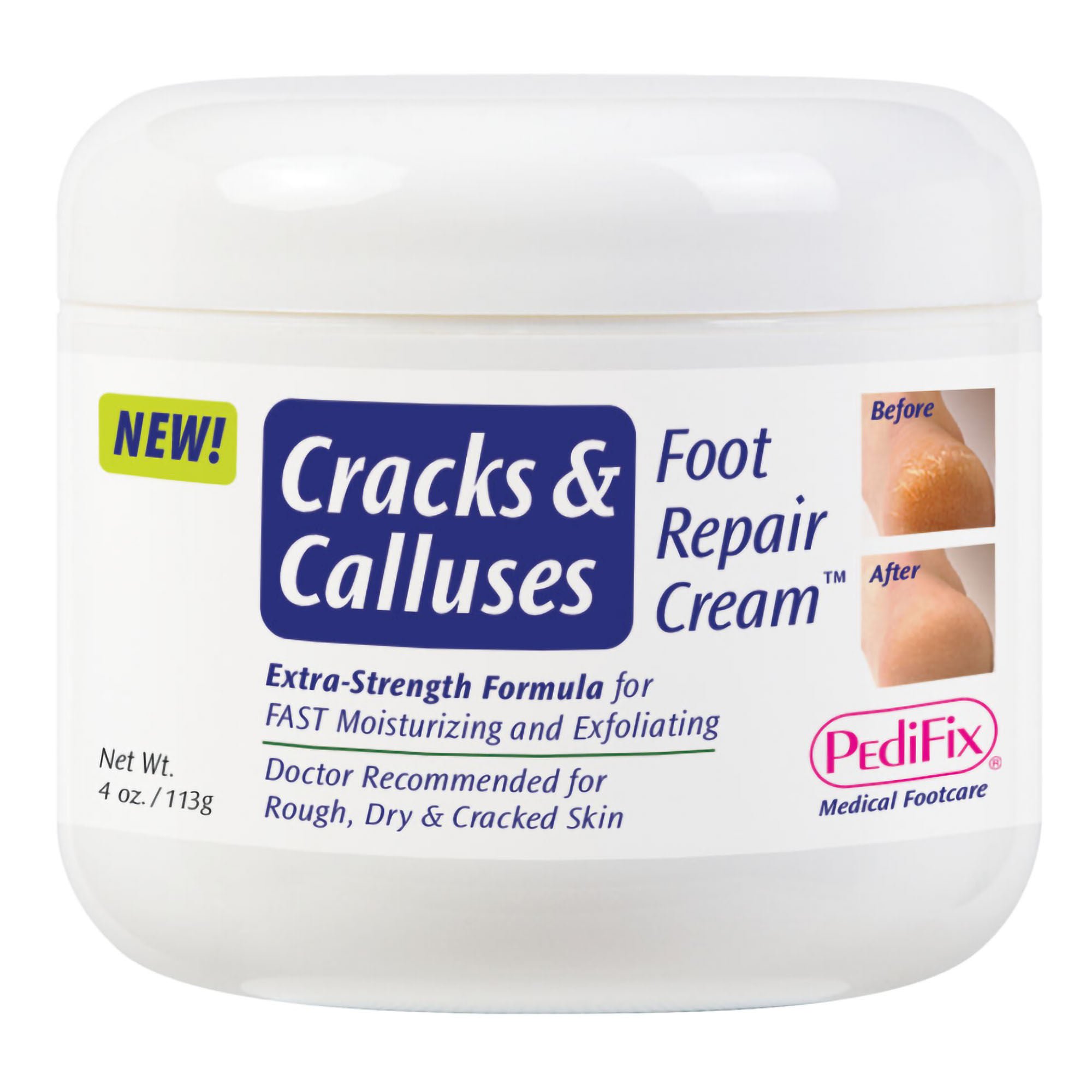 PediFix® Cracks and Calluses Foot Repair Cream™, 4-ounce Jar