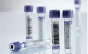 Vacuette® Venous Blood Collection Tube, 4 mL, 13 x 75 mm