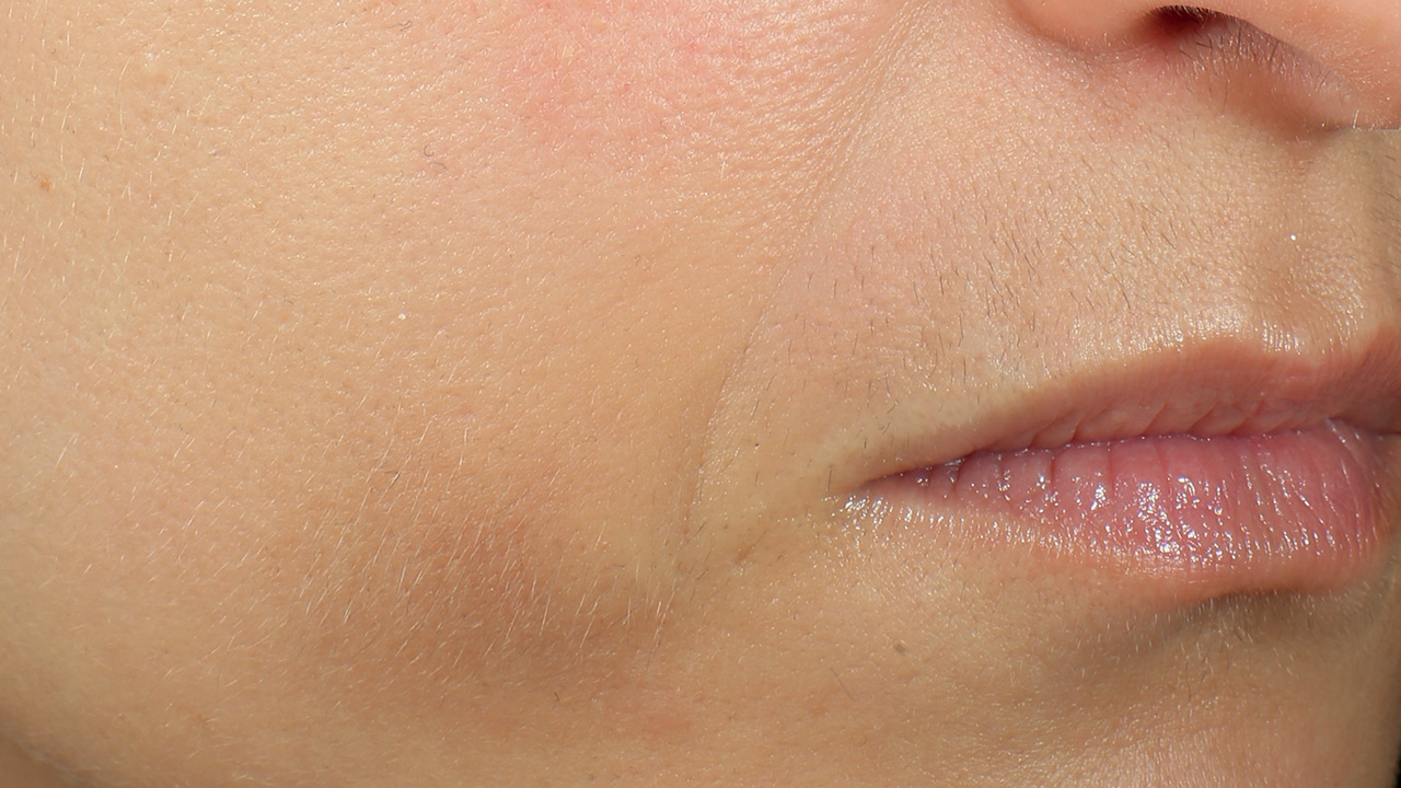 Bild nach der Behandlung