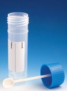 Globe Scientific CONTAINER, STOOL SPECIMEN 30MLW/LABEL (500/CS)