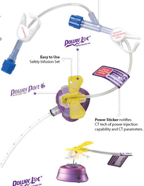 PowerLoc® Huber Infusion Set
