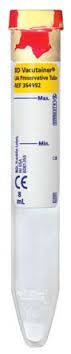 BD Vacutainer® Urinalysis Tube, 16 x 100 mm, 8 mL
