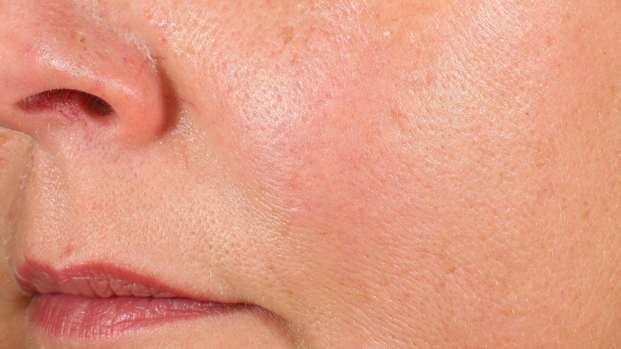 Immagine dopo il trattamento