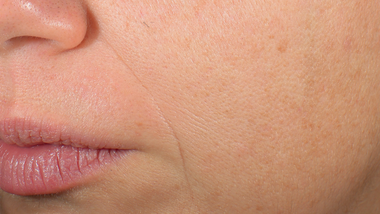 Bild vor der Behandlung