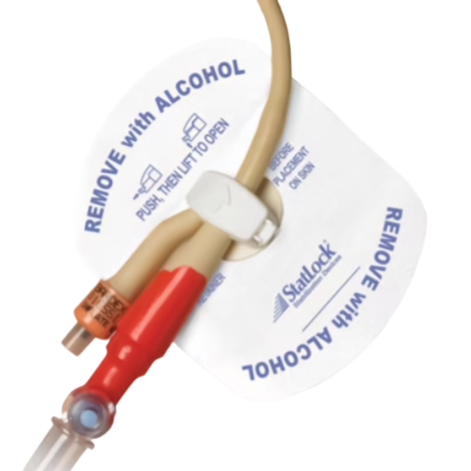 Statlock® Stabilization Device