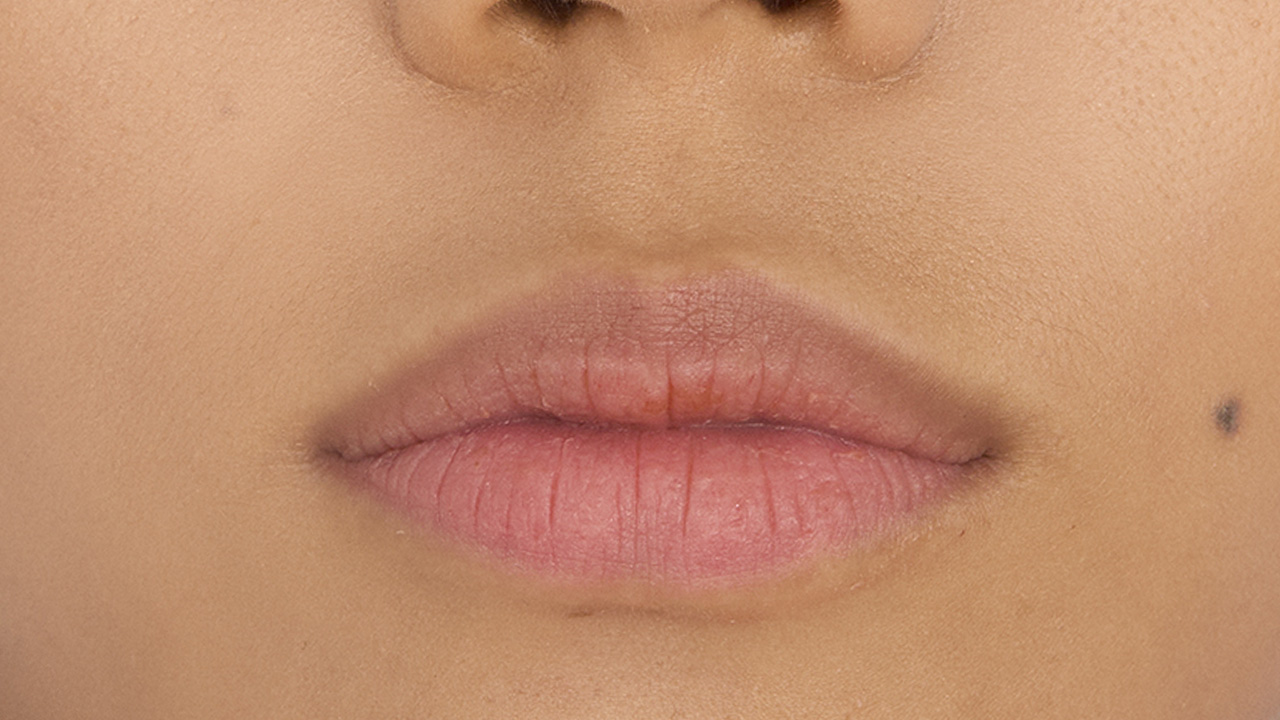 Afbeelding voor behandeling