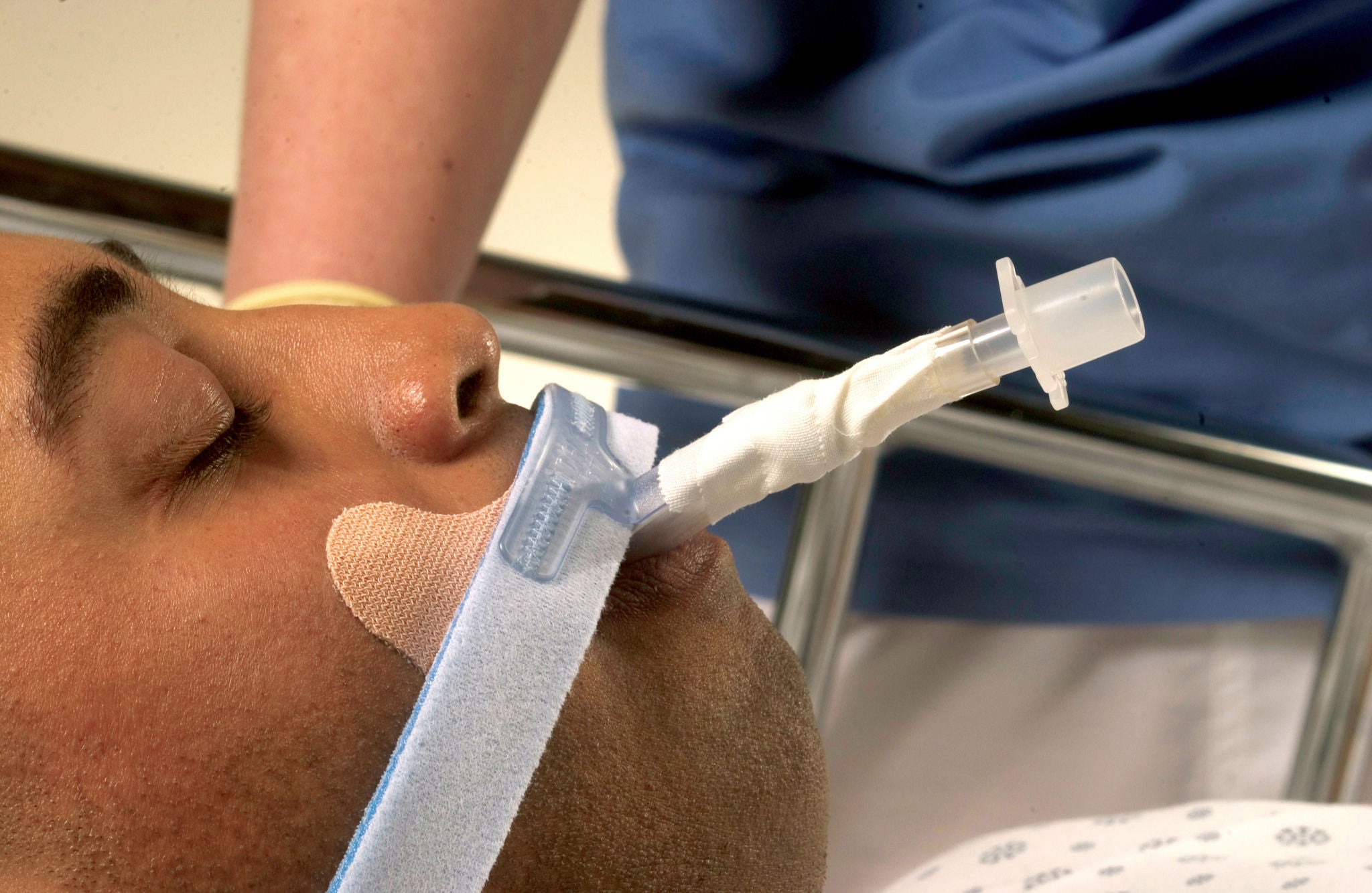 Stabilock™ Endotracheal Tube Holder