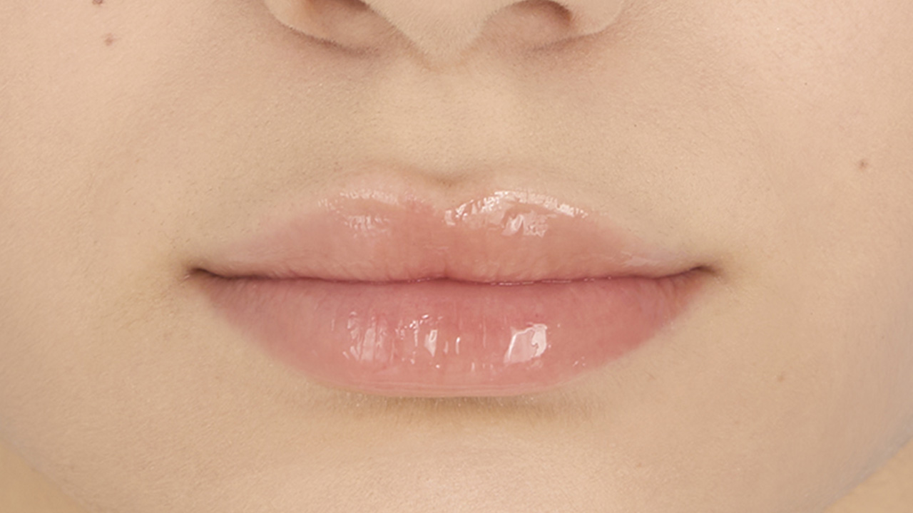 Immagine dopo il trattamento