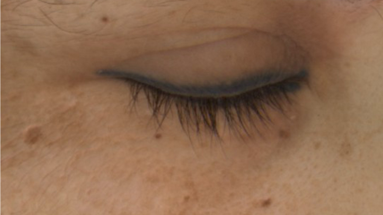 After image