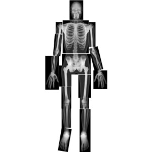 True to Life Human X-Ray Set, Pack of 18