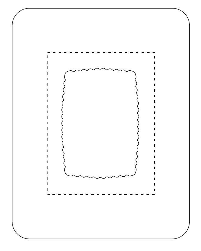SorbaView® 2000 Transparent Film Dressing with Pad