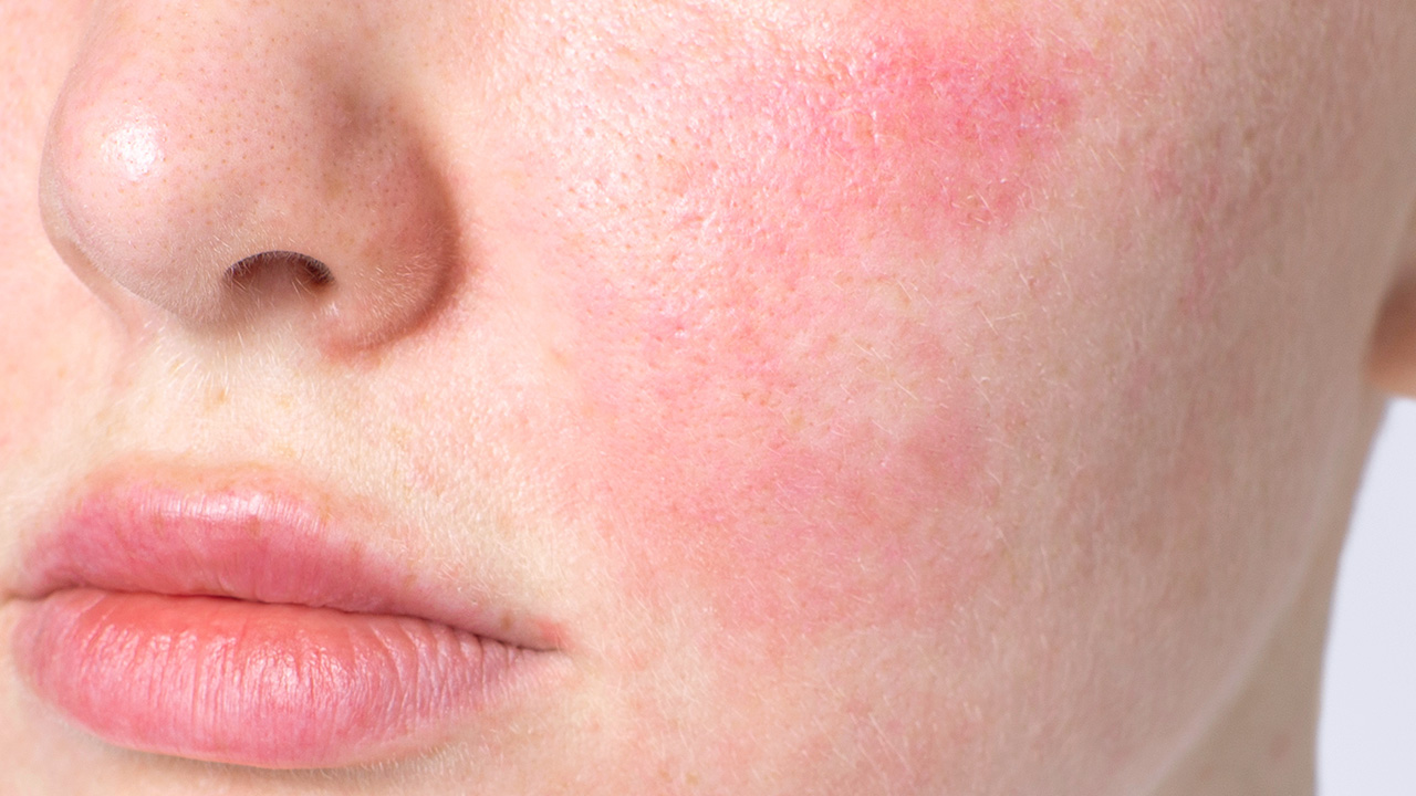 Bild der klinischen Ergebnisse