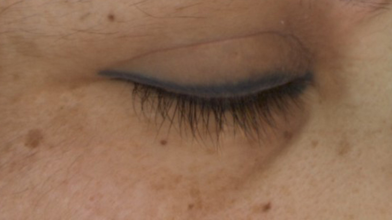 Before image
