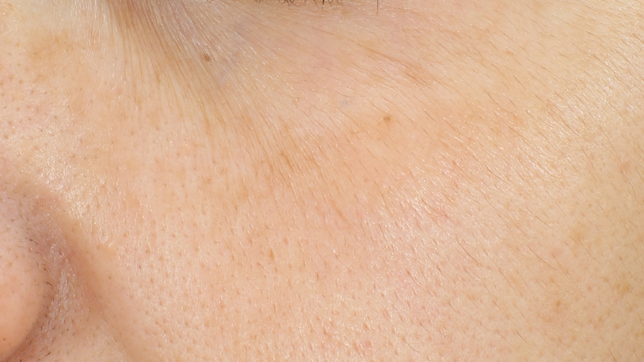 Bild nach der Behandlung