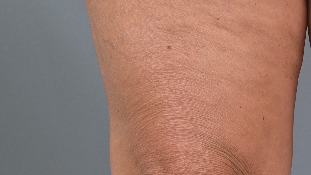 Immagine prima del trattamento