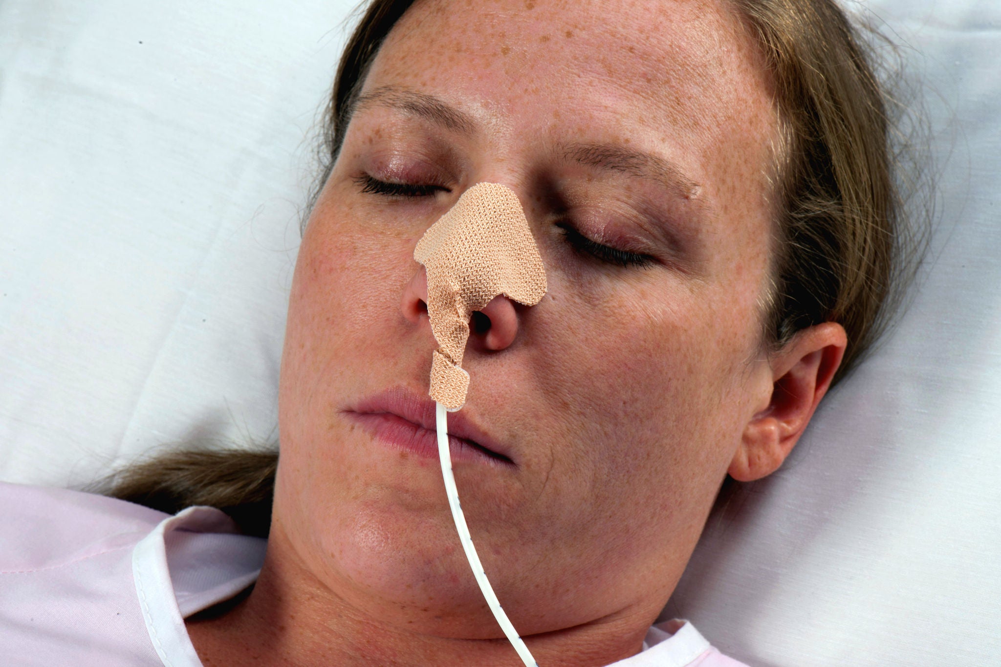 Dale® Nasogastric Tube Holder for Nasogastric Feeding and Aspiration Tubes