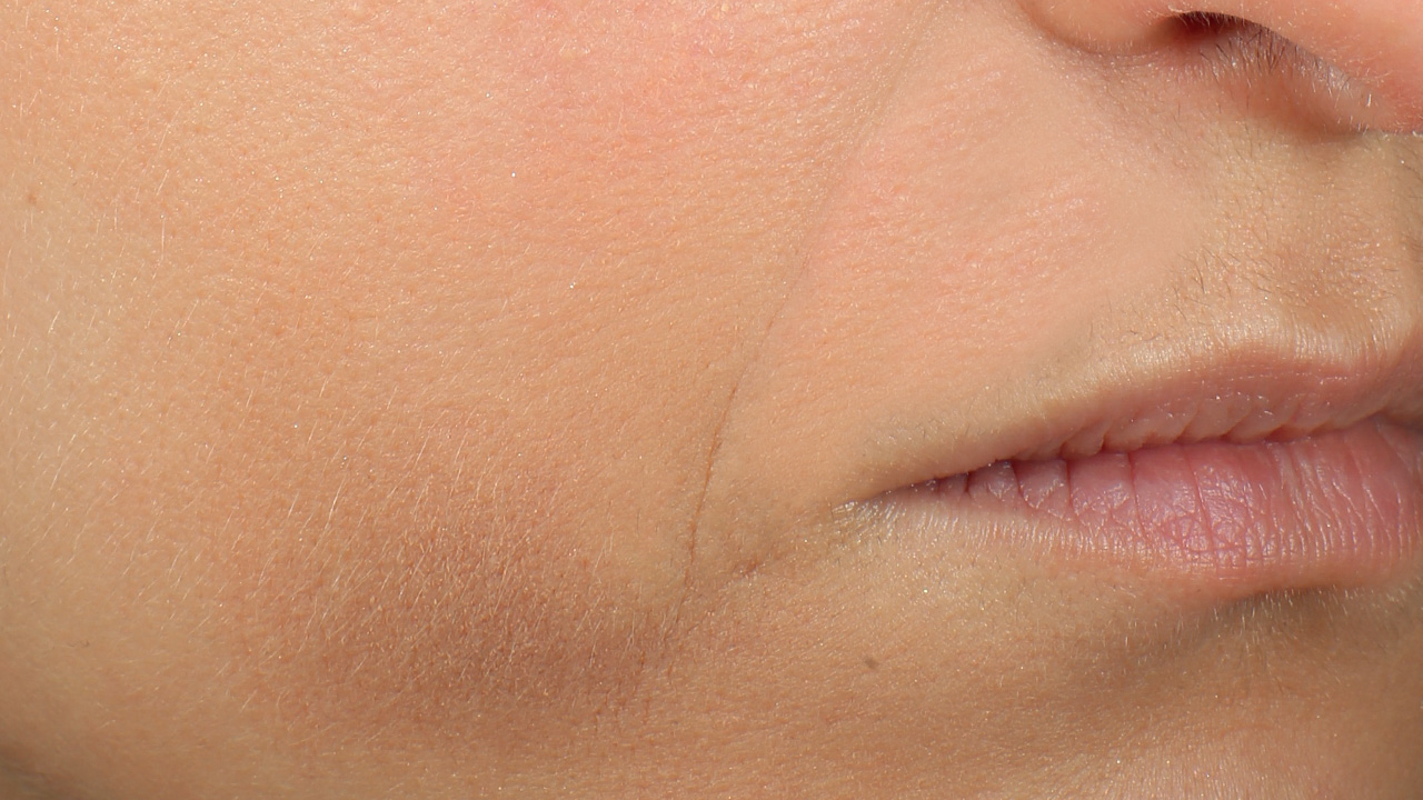 Bild vor der Behandlung