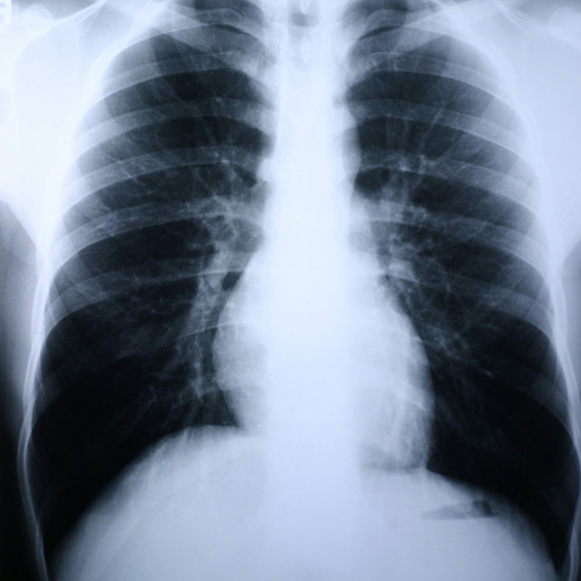 Clear Choice Performance X-Ray Film MK 456488