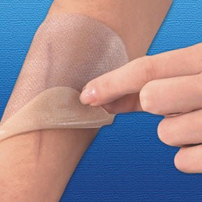 Gel-Care® Advanced Scar Therapy