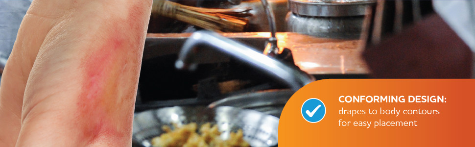 Conforming design: drapes to body contours for easy placement