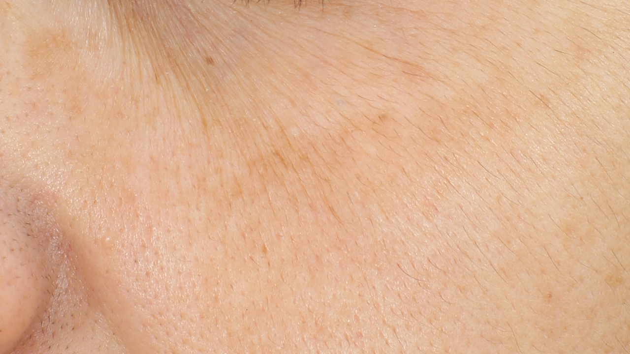 Bild vor der Behandlung