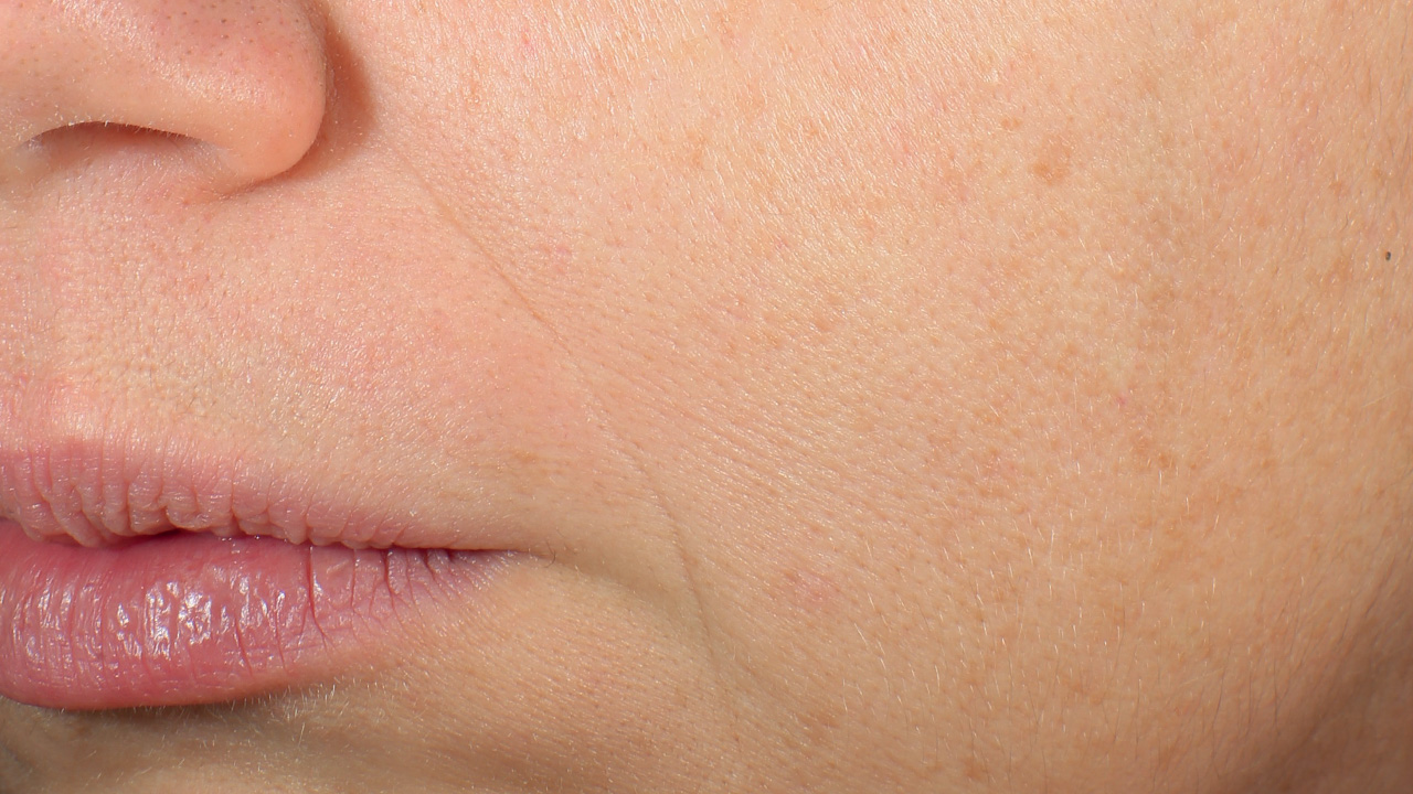 Bild nach der Behandlung