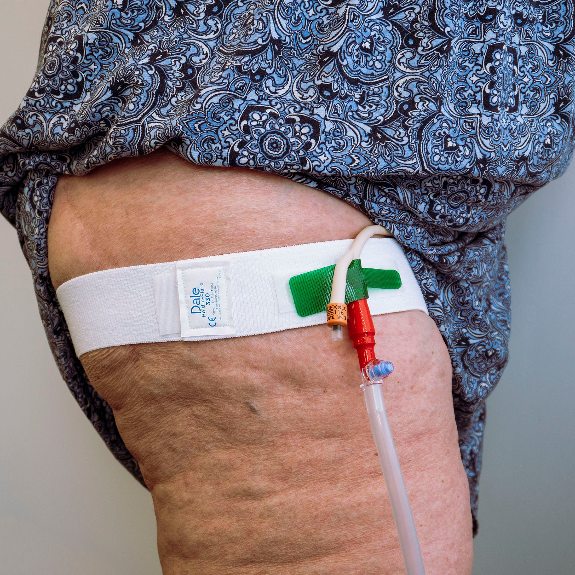 Dale® Leg Strap/Waist Band, holds Catheter, fits legs and waists up to 56 Inches