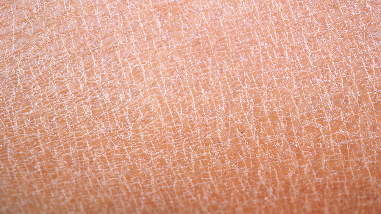 Immagine dei risultati clinici