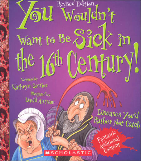 You Wouldn't Want to be Sick in the 16th Century!