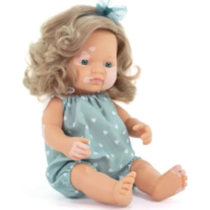 My Friends & Me Baby Doll, Caucasian Girl With Vitiligo, 15", Boxed