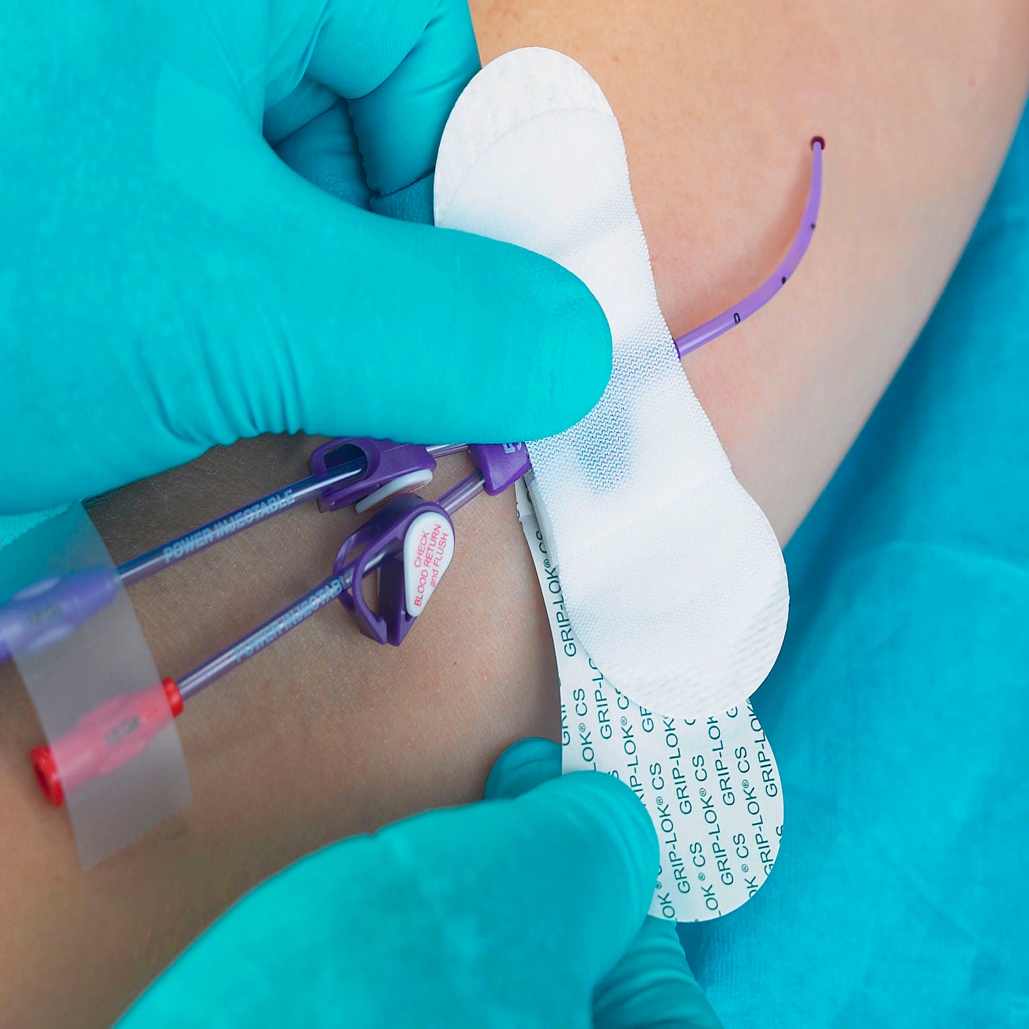 Tidi Products Catheter / Line Securement Device Grip-Lok® Fits Bard Hub