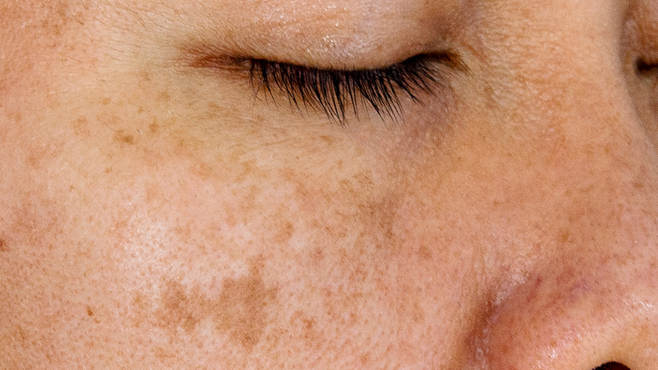 Clinical results image