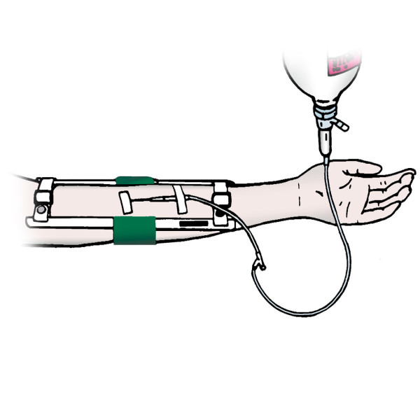 Child Elbow Immobilizer - 7"