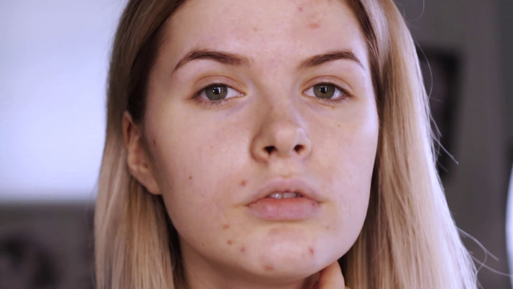 PanOxyl Acne Creamy Wash Daily Control, Face & Body, 4 Benzoyl