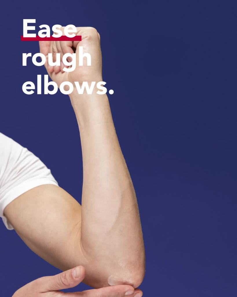 thumbnail video image 2 of Aquaphor Healing Ointment Skin Protectant For Dry and Cracked Skin, 1.75 oz. Tube, 2 of 18