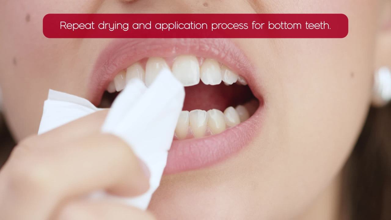 thumbnail video image 2 of Colgate Optic White Express Teeth Whitening Gel Pen, 7 Day Whitening Treatment, 0.08 oz, 2 of 16