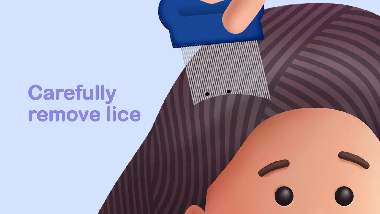 thumbnail video image 2 of Nix Complete Lice Treatment Kit, Lice Treatment for Hair, Lice Spray for Home, Lice Comb, 2 of 14