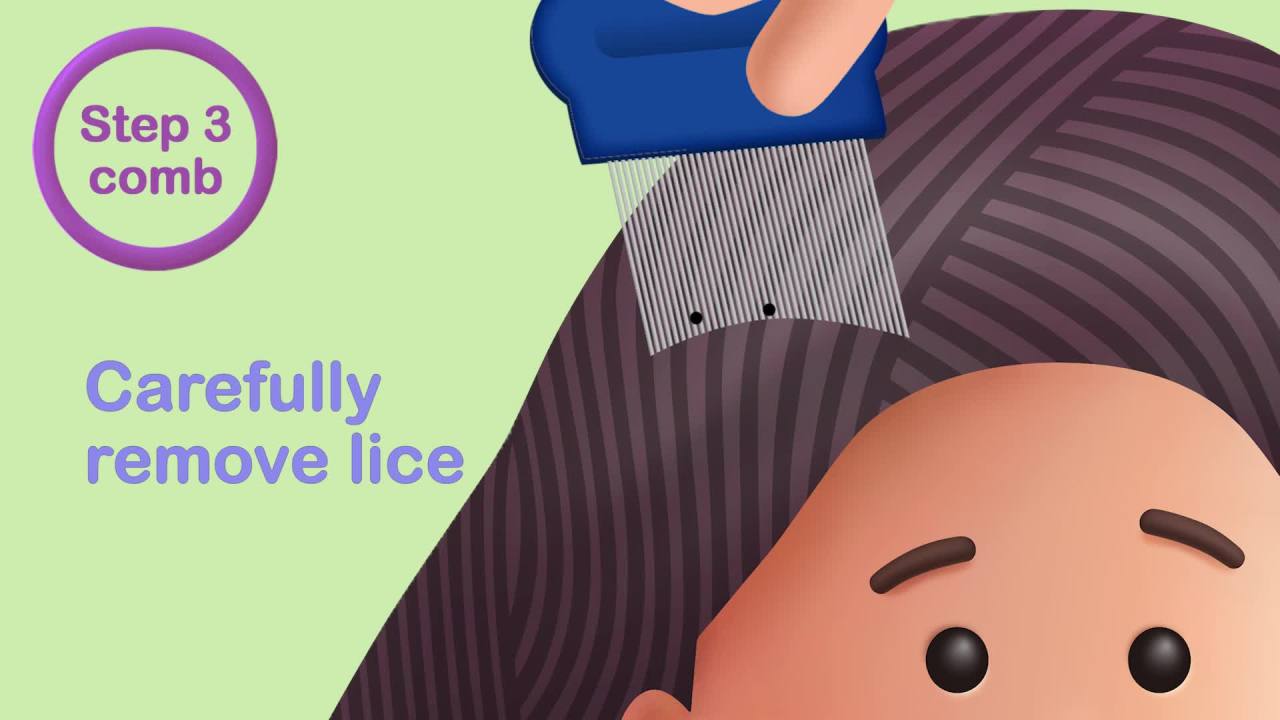 thumbnail video image 2 of Nix Ultra Superlice Treatment, All-in-One Shampoo, 4 fl oz & Lice Removal Comb, 2 of 14