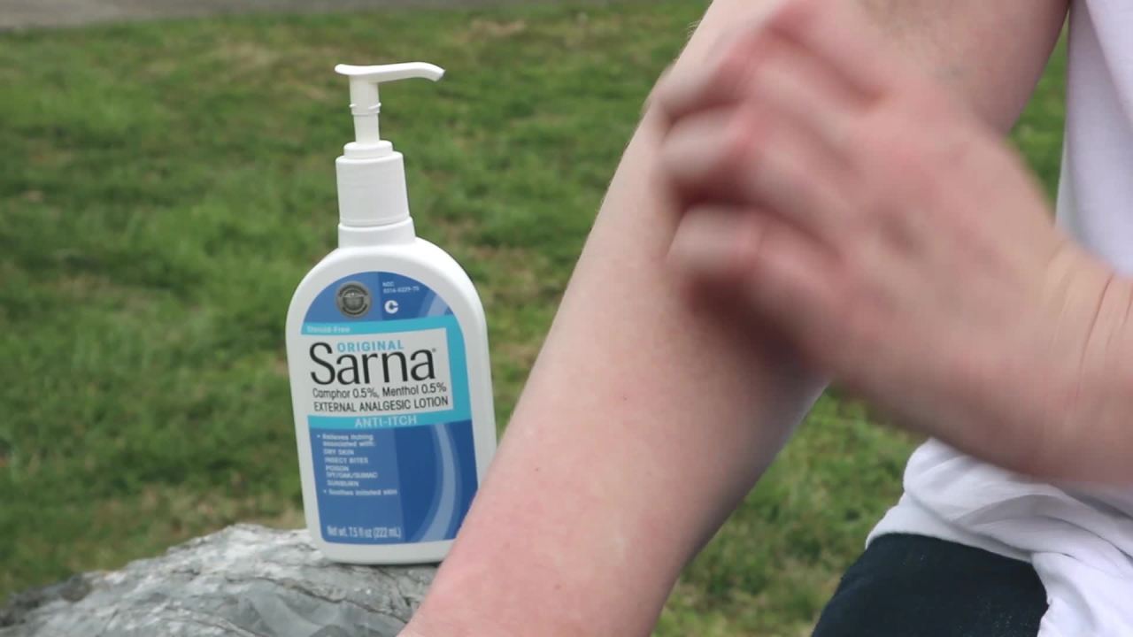 thumbnail video image 2 of Sarna Original Steroid-Free Anti-Itch Cooling and Soothing Lotion, 7.5 oz, 2 of 10